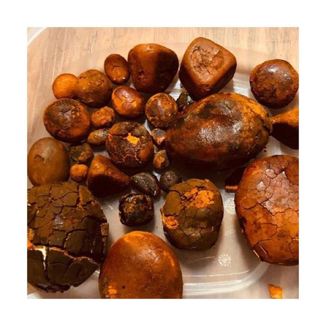 Sun-Dried Cow Gallstone - Premium Quality