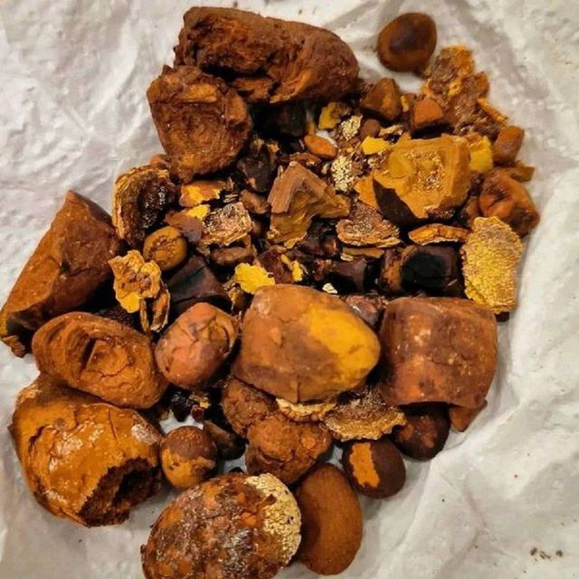 Cattle Gallstone
